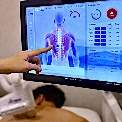 EMMA operator screen showing body localisation and treatment settings